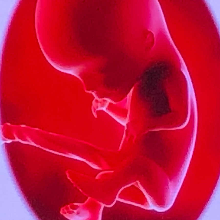 Congresso Mundial de Medicina Fetal - Clínica Médica Yoshida - 4