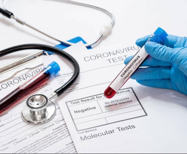 Já temos o exame para Corona Vírus - Clínica Médica Yoshida